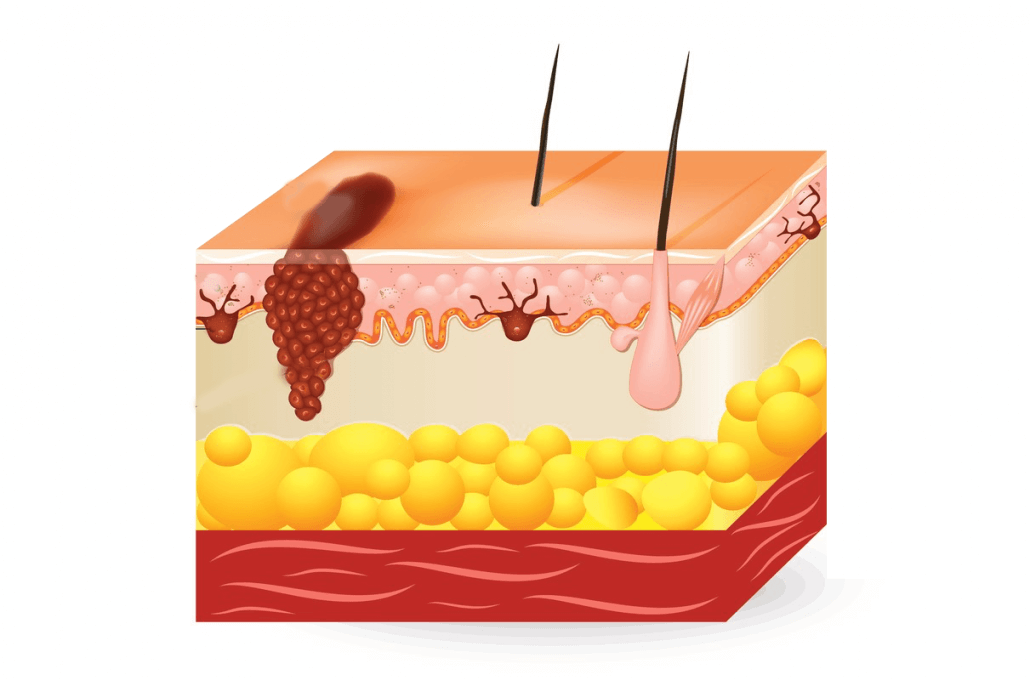 Haut Chirurgicum Berlin